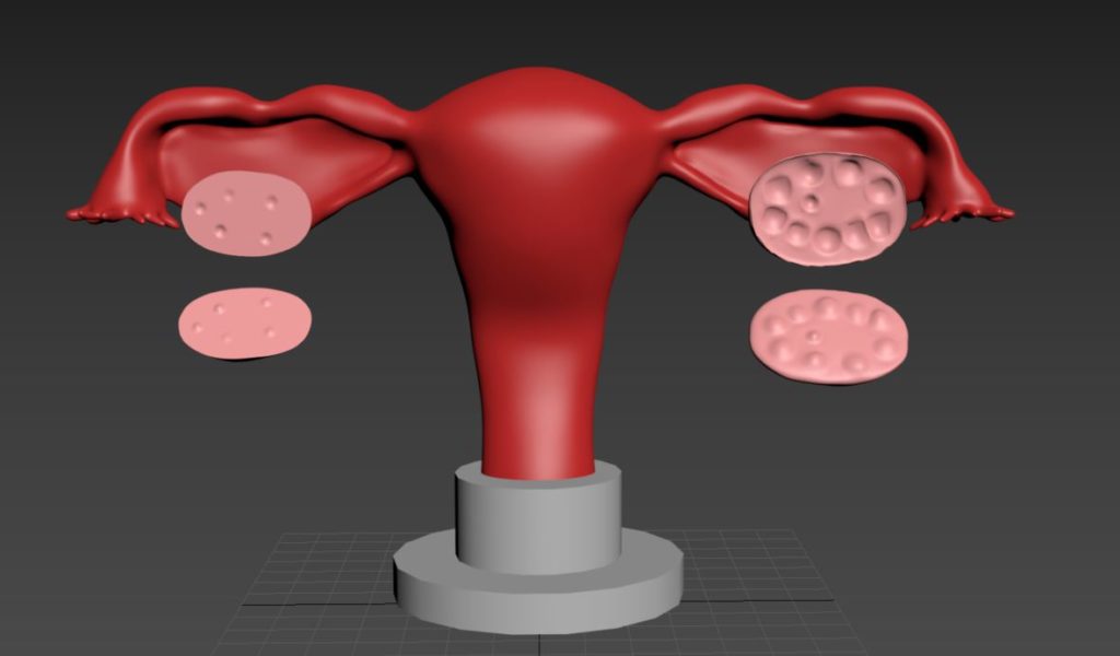 Utero em 3D